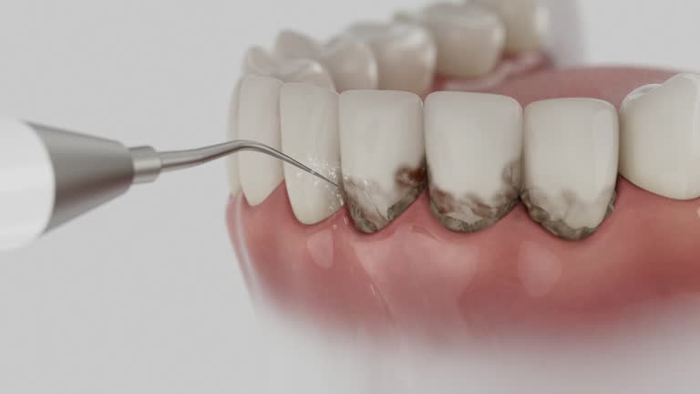 Trusted Root Canal Treatment service in Grambling, LA - Dentist Open Now